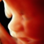 3d ultrasound image