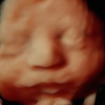 3d ultrasound image