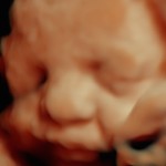 3d ultrasound image