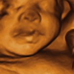 baby scan