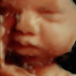 3d ultrasound image