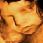 baby 3D Ultrasound