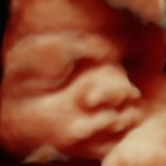 3d ultrasound face image
