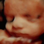 3d ultrasound image