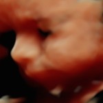 3d ultrasound image