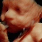 3d ultrasound image