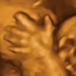 3D ultrasound image of the baby