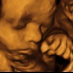 3D Ultrasound baby scan