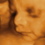 baby 3D Ultrasound in oakville