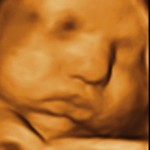 baby 3D Ultrasound burlington
