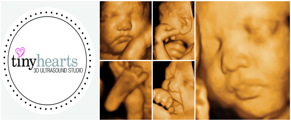 3D Ultrasound Video Oakville: Meet Your Baby Before Birth