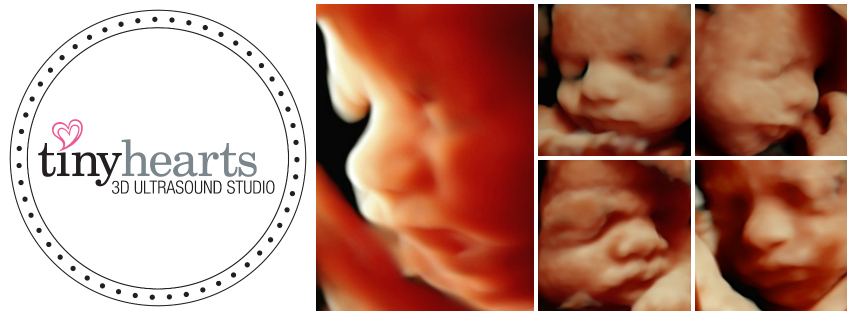 Your Guide to a Personalized Experience at a 4D Ultrasound Studio in Burlington