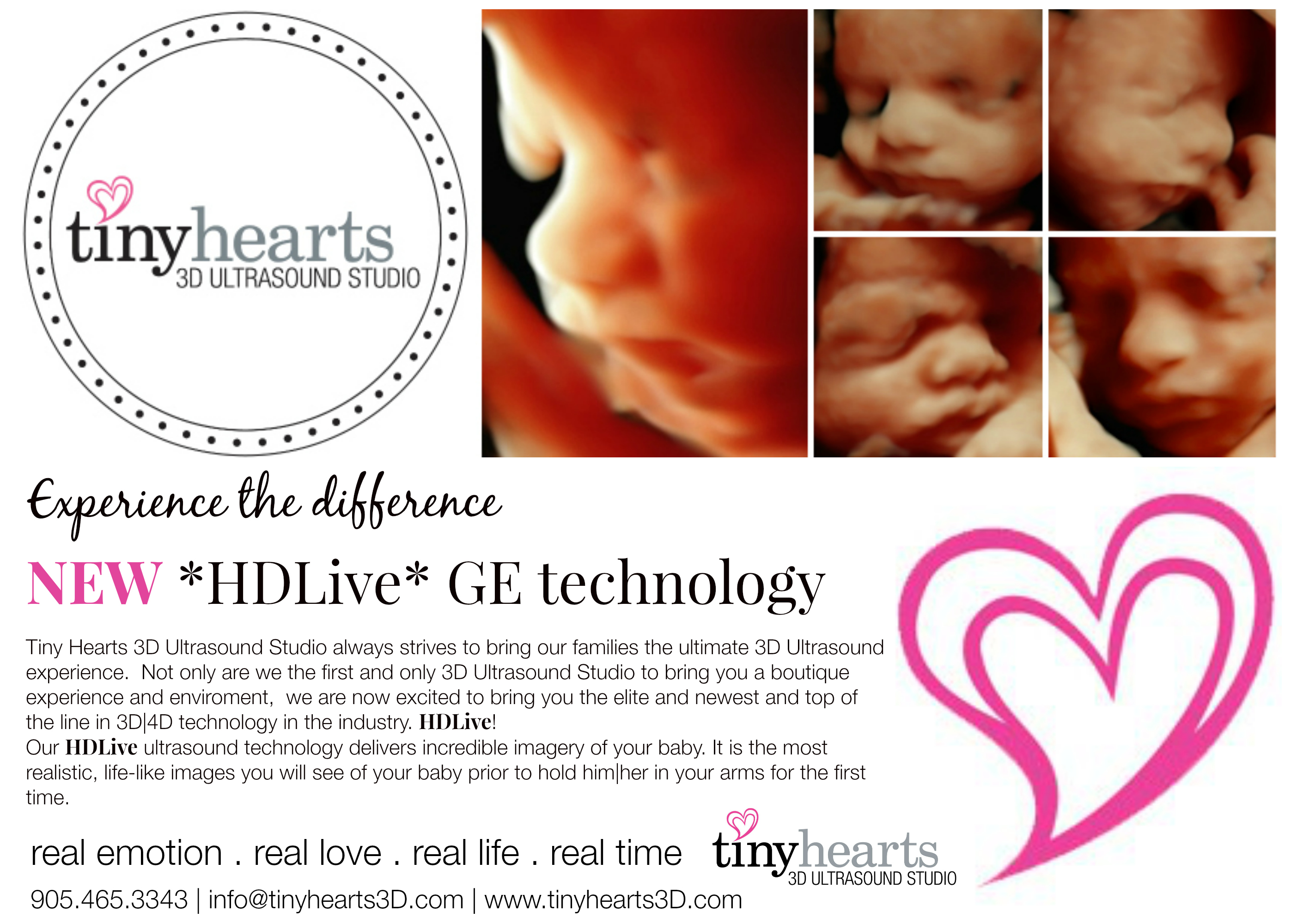 When Is the Best Time for a 3D Pregnancy Scan in Oakville?