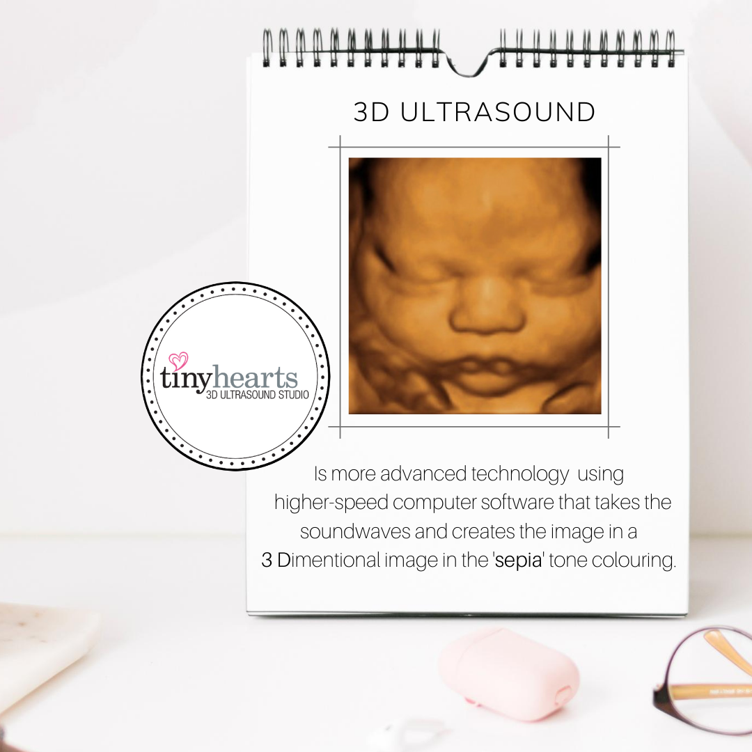 A Closer Look at 3D Ultrasound Pregnancy in Oakville: What Expecting Parents Should Know
