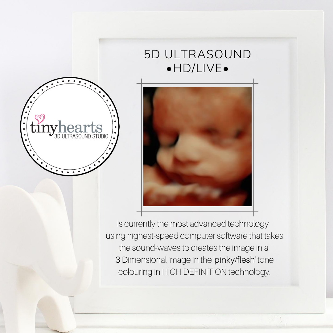 Experience the Difference: Why Tiny Hearts Is Oakville’s Top Ultrasound Clinic for Expectant Families